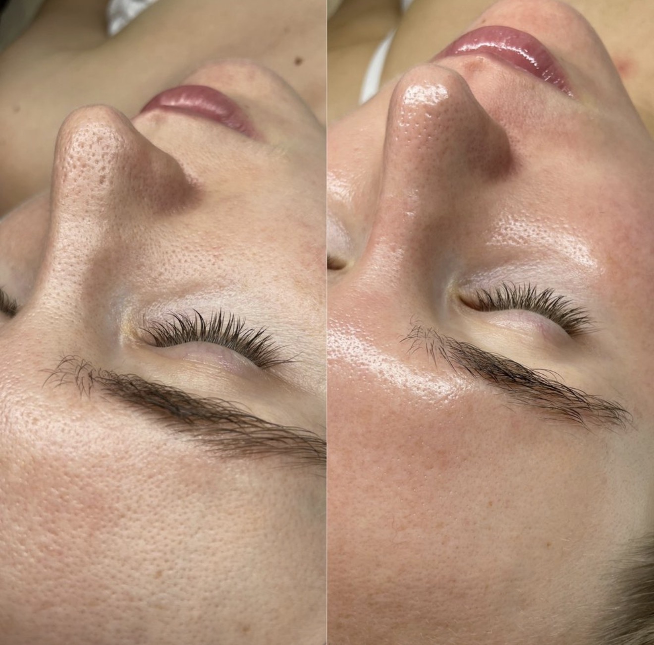 Real client before and after results at K&K Facial Spa