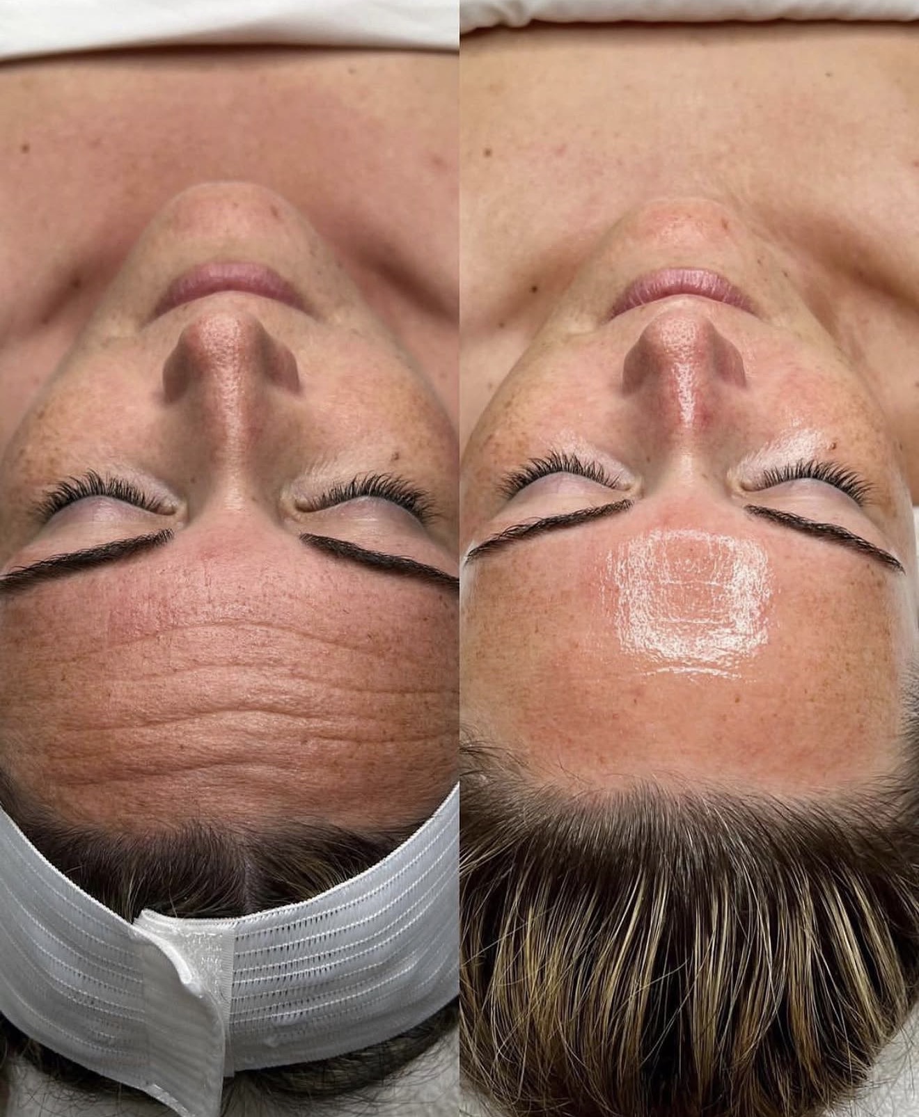 Real client before and after results at K&K Facial Spa