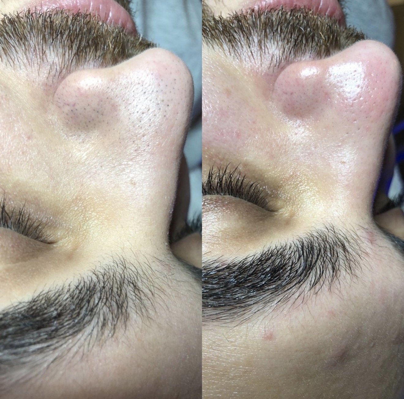 Real client before and after results at K&K Facial Spa