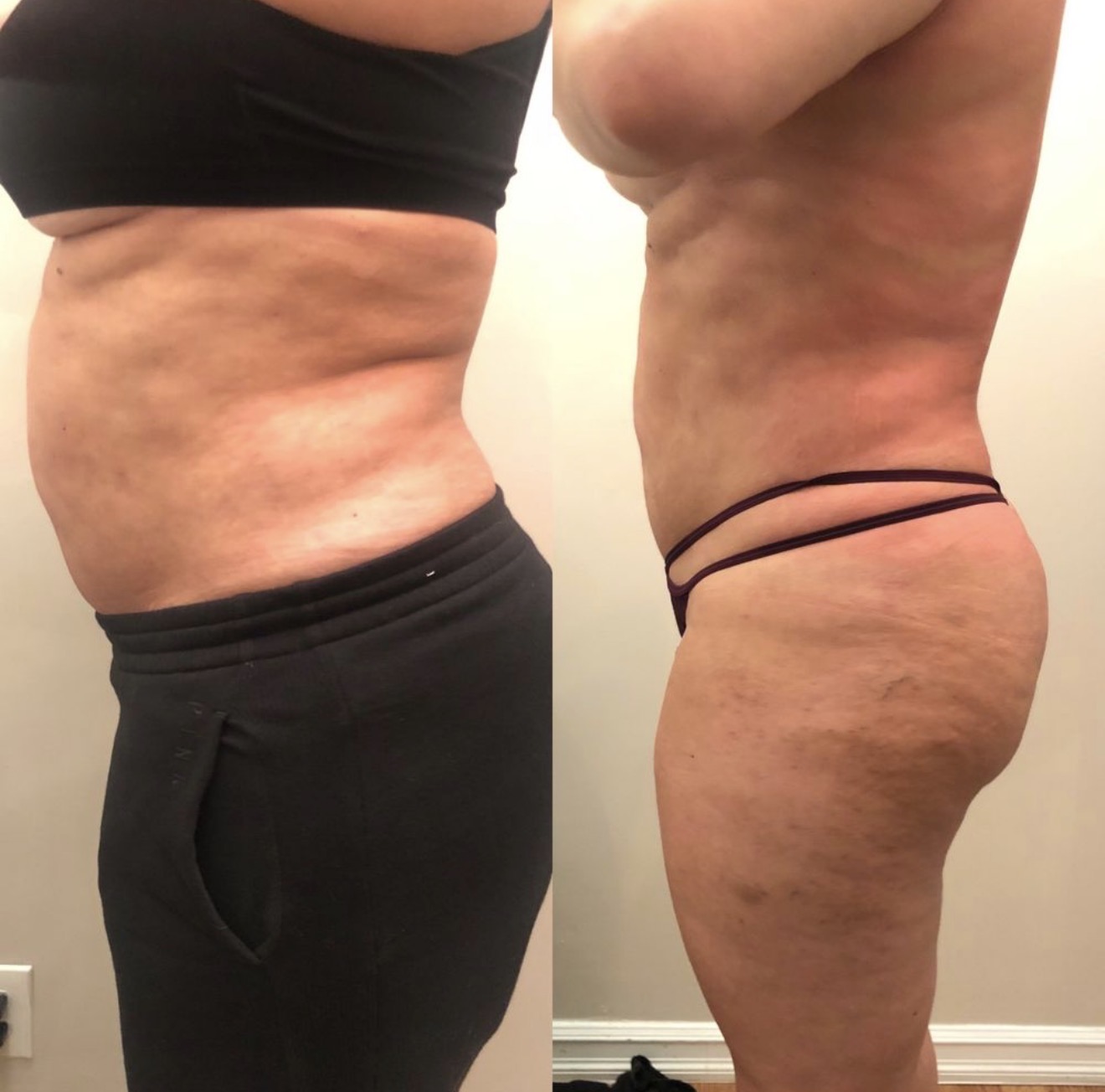 Real client before and after results at K&K Facial Spa