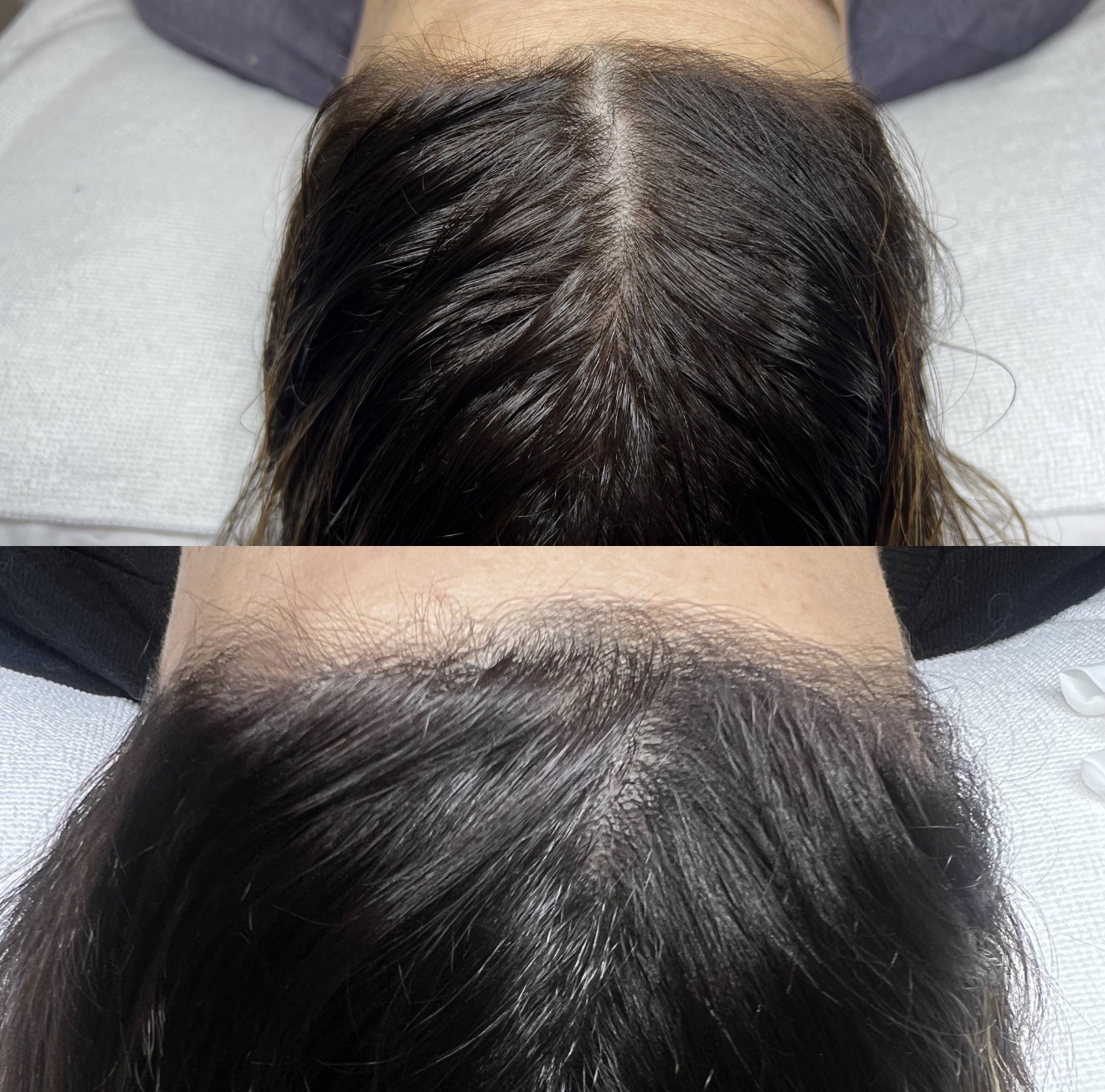 Real client before and after results at K&K Facial Spa