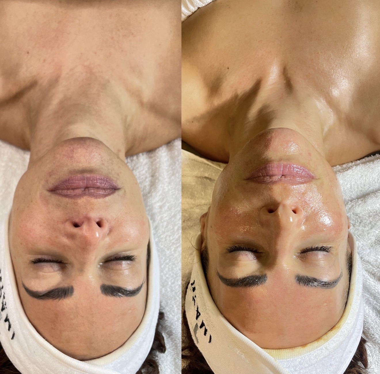Real client before and after results at K&K Facial Spa