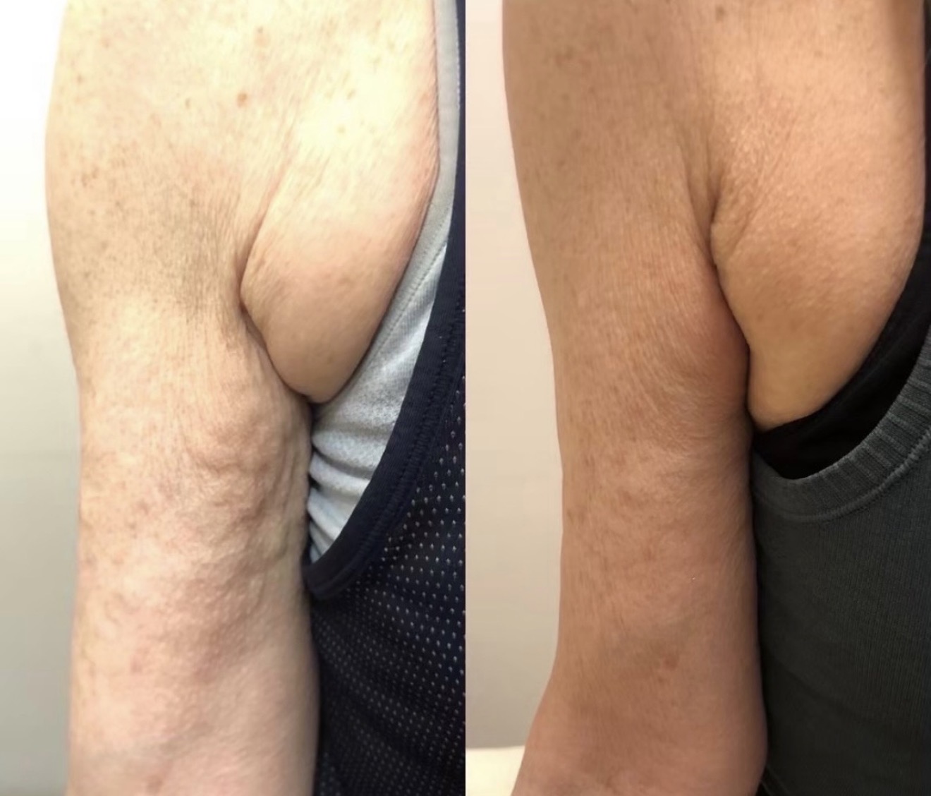 Real client before and after results at K&K Facial Spa